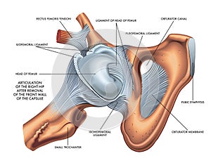 Illustration of hip articulation with annotation photo