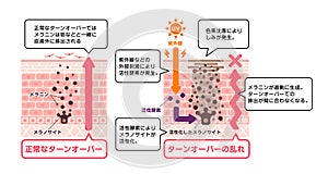 Illustration of how skin spots (hyperpigmentation) are created