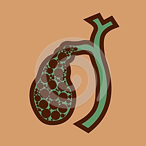 Illustration of Human gallbladder and gallstones anatomy