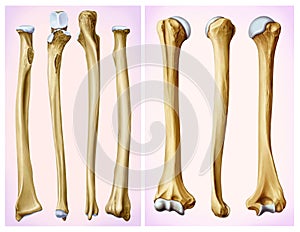 Front and side view of the humerus and radial bone.