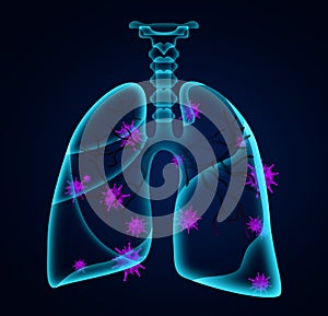 Illustration of human lungs affected with disease on background