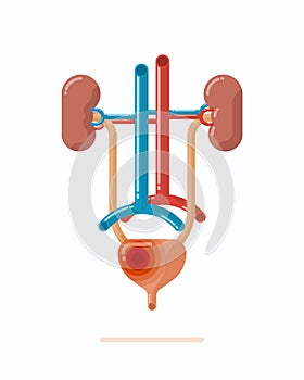 Illustration of human urinary system with disease, flat design vector illustration