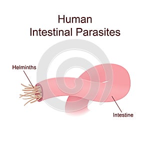 Illustration of internal human parasites