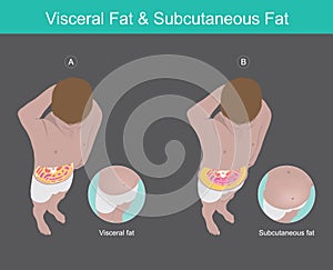 Visceral Fat & Subcutaneous Fat Illustration. Illustration knowledge of the abdomen visceral fat in human photo