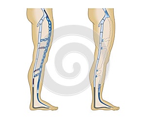 Illustration leg veins