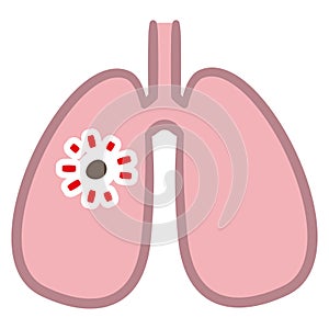 Illustration of lungs on white background, Aspiration