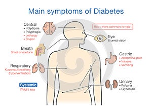 Illustration of main symptoms of Diabetes.