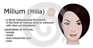 Illustration of Milium