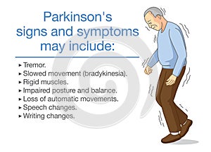 Illustration about Parkinson`s disease symptoms and sign.