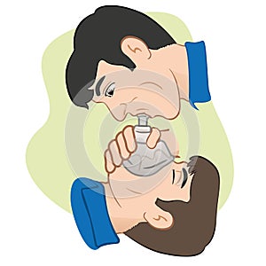 Illustration of a person with respiratory arrest being revived with the help of a pocket mask to help with breathing