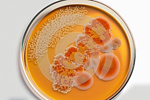 Illustration of petri dish with growing cultures of microorganisms, fungi pathogen to crops