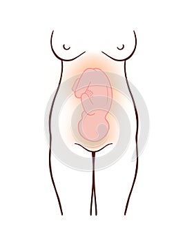 Illustration of pregnant woman