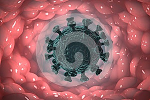 An illustration showing a coronavirus in the alveoli of the lungs.