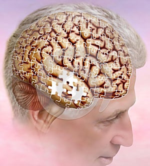 Alzheimer`s, the disease of forgetfulness Alzheimer`s and lost thoughts. photo