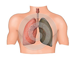 Human lungs, bronchi