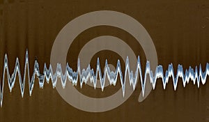 Illustration of the wave form photo