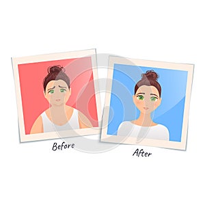 Illustration of a woman before and after weight loss
