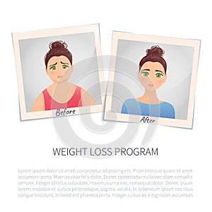 Illustration of a woman before and after weight loss