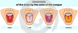 Illustrationn of the different colors of a tongue with inscriptions