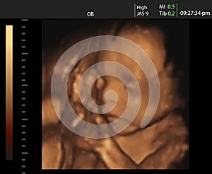Image of 3D ultrasound of baby