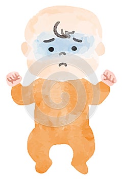 The image of a Baby with bad complexion