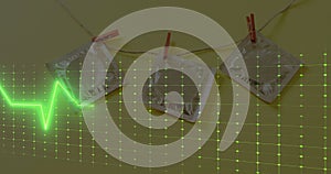 Image of cardiograph over protectives on yellow background