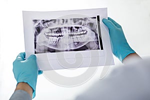 Image of male doctor or dentist holding and looking at dental x-ray