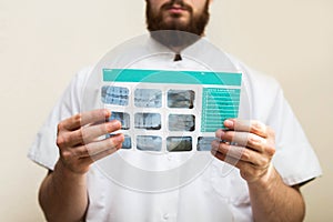 Image of male doctor or dentist holding and looking at old dental x-ray, analyzing