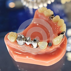 The image of the model of the human jaw and dentures.