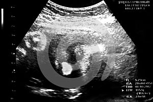 Image ultrasound baby face photo