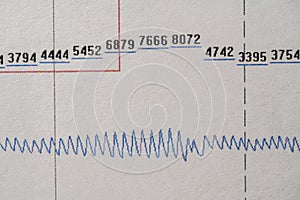 Images charts scientific cardiograms of cardiorespiratory sleep monitoring. Heart pulse or Heart wave, graph on paper. Medical photo