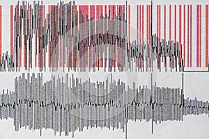 Images charts scientific cardiograms of cardiorespiratory sleep monitoring. Heart pulse or Heart wave, graph on paper. Medical photo