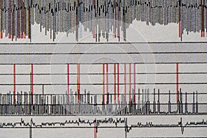 Images charts scientific cardiograms of cardiorespiratory sleep monitoring. Heart pulse or Heart wave, graph on paper. Medical photo