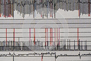 Images charts scientific cardiograms of cardiorespiratory sleep monitoring. Heart pulse or Heart wave, graph on paper. Medical