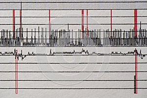 Images charts scientific cardiograms of cardiorespiratory sleep monitoring. Heart pulse or Heart wave, graph on paper. Medical photo