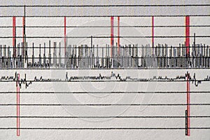 Images charts scientific cardiograms of cardiorespiratory sleep monitoring. Heart pulse or Heart wave, graph on paper. Medical photo
