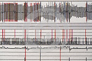 Images charts scientific cardiograms of cardiorespiratory sleep monitoring. Heart pulse or Heart wave, graph on paper. Medical photo