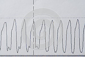 Images charts scientific cardiograms of cardiorespiratory sleep monitoring. Heart pulse or Heart wave, graph on paper. Medical photo