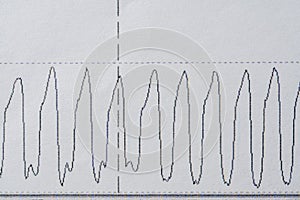 Images charts scientific cardiograms of cardiorespiratory sleep monitoring. Heart pulse or Heart wave, graph on paper. Medical