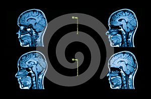 Images from a computerized tomography of the brain