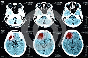 Images from a computerized tomography of the brain