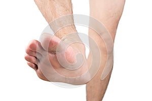 Images of peeling and cracked feet Causes of peeling and cracked skin no shoes on a white background, health concept