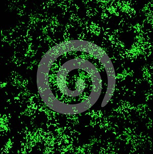 Imaging of breast cancer cells expressing Green Fluorescent Protein