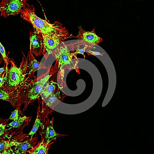 Imaging of metastatic cancer cells