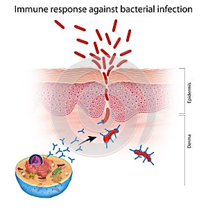 Immune response against bacterial infection