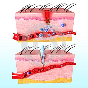 Immune response system of human skin