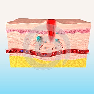 Immune response system of human skin