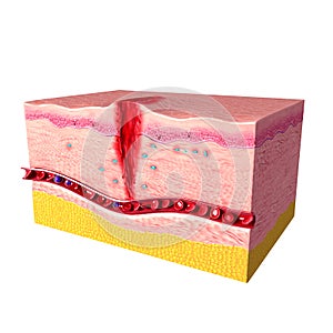 Immune response system of human skin