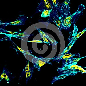 Immunofluorescence confocal imaging of fibroblasts