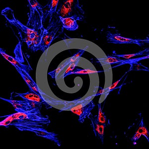 Immunofluorescence confocal imaging of a melanoma cancer cell line